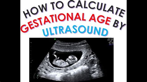 dating ultrasound calculator